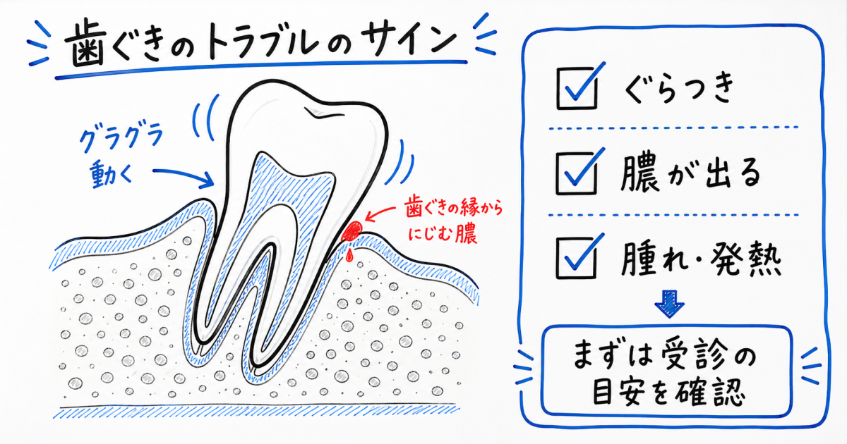 歯がぐらぐらして膿が出る…今すぐ受診？歯を残す治療と受診基準