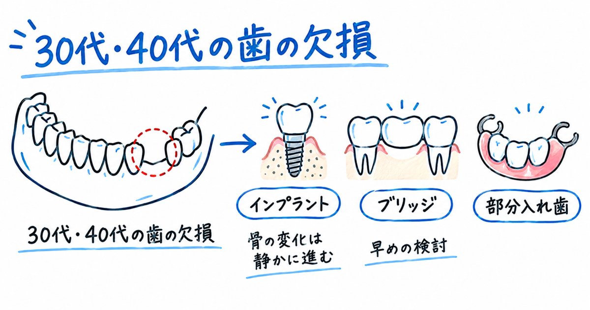 30代40代で歯を失ったら？早期治療が推奨される理由と選択肢