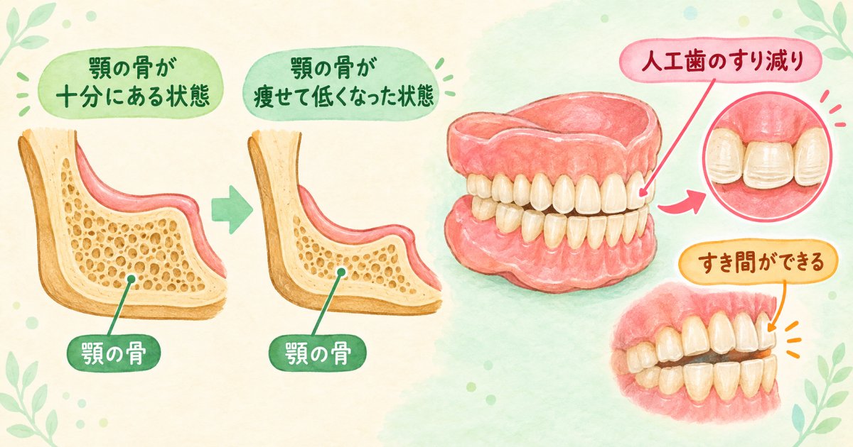 入れ歯が痛い・外れやすい原因は歯茎の変化か義歯の劣化か