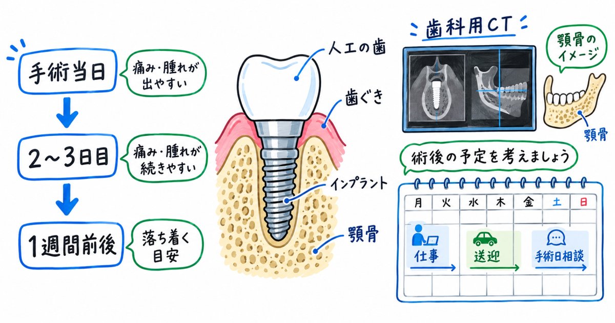 インプラント術後の痛みはいつまで？仕事と送迎の予定の立て方