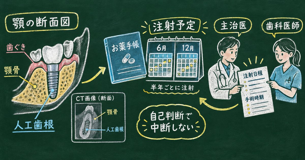 骨粗鬆症で人工歯根を選ぶ際の注意点｜服薬の確認と主治医との連携